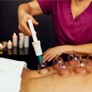 Cupping Massage